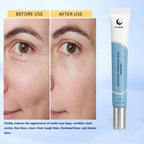 Instant Firming Eye Serum Anti-Aging Formula For Under Bags And Wrinkles Cream Wrinkle Filler Visibly Improves Dark Circles Treatment Puffines (3, 0.49 Fl Oz)