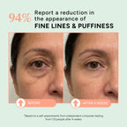 Eight Saints Skin Care All In Eye Cream, Anti Aging Eye Cream To Reduce Puffiness, Wrinkles, & Eye Bags, Dark Circles Eye Treatment, With Hyaluronic Acid, Vitamin C, & Peptides, 0.5 Ounces