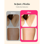 LYSMOSKI Laser Hair Removal for Women and Men, At-Home IPL Hair Removal Device with 5.2 cm² Treatment Window, Nearly Painless, Visible Results in 2 Weeks, Full Body Treatment in 8 Minutes, white