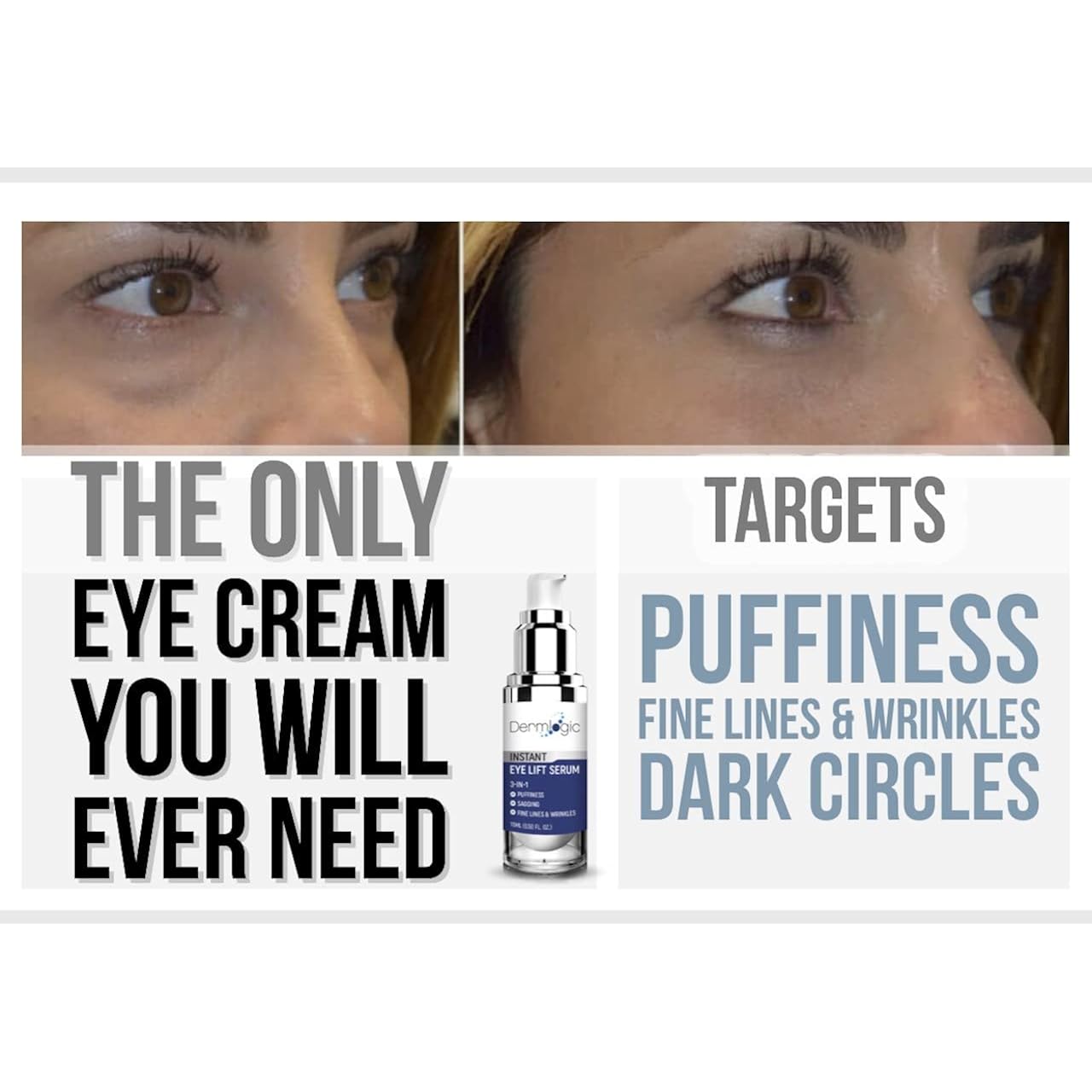 Under Eye Puffiness & Dark Circles Rapid Treatment- Instantly Reduces The Appearance Of Puffy Eye Bags, Crow’S Feet, & Sagging Skin.