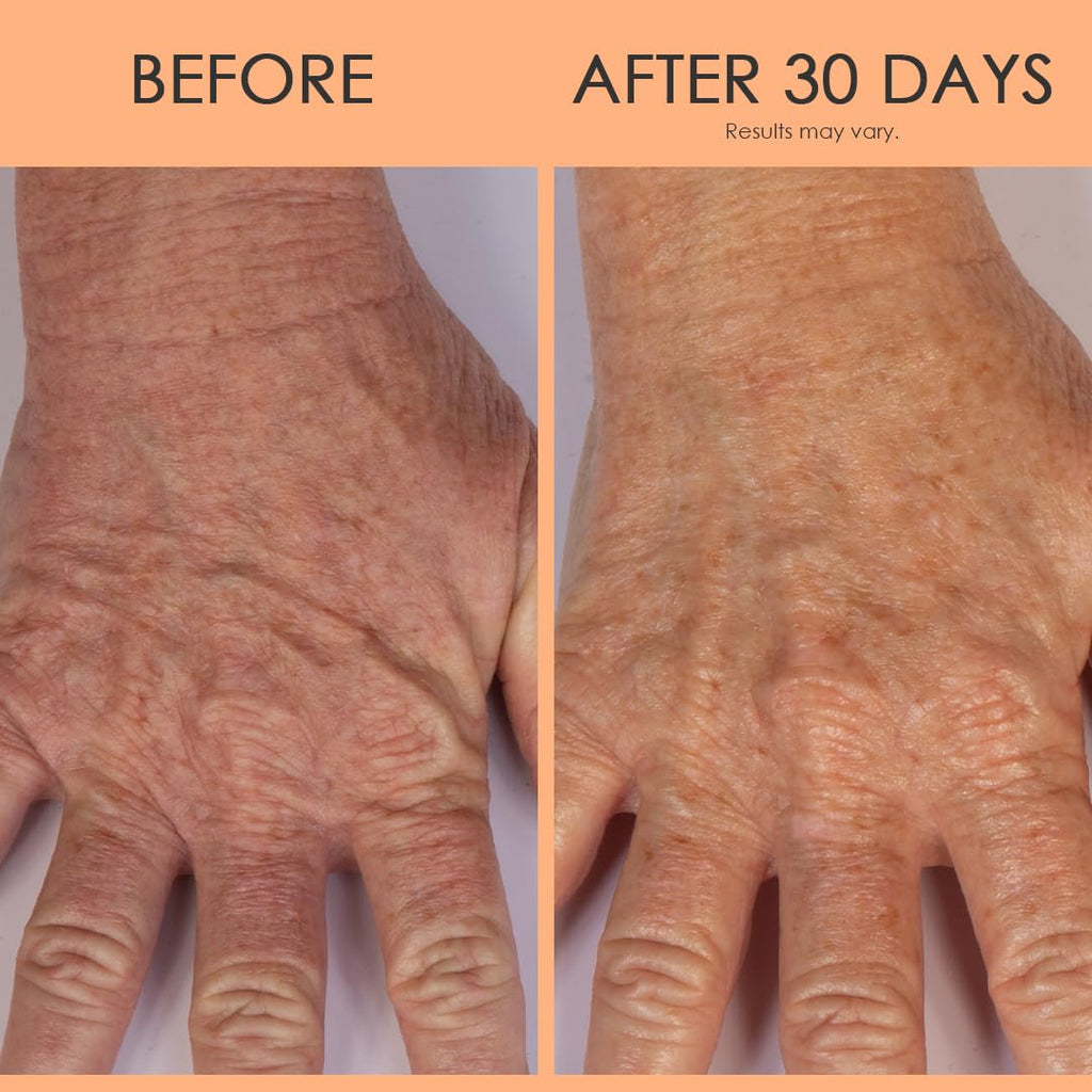 BODY FIRM Crepe Erase Hand Repair Treatment, Anti-Aging Hand Treatment, Lotion with Moisturizing Shea Butter, Vitamin E and Squalane for Cracked, Dry Hands, Supports Wrinkle on Hands, 3 fl oz