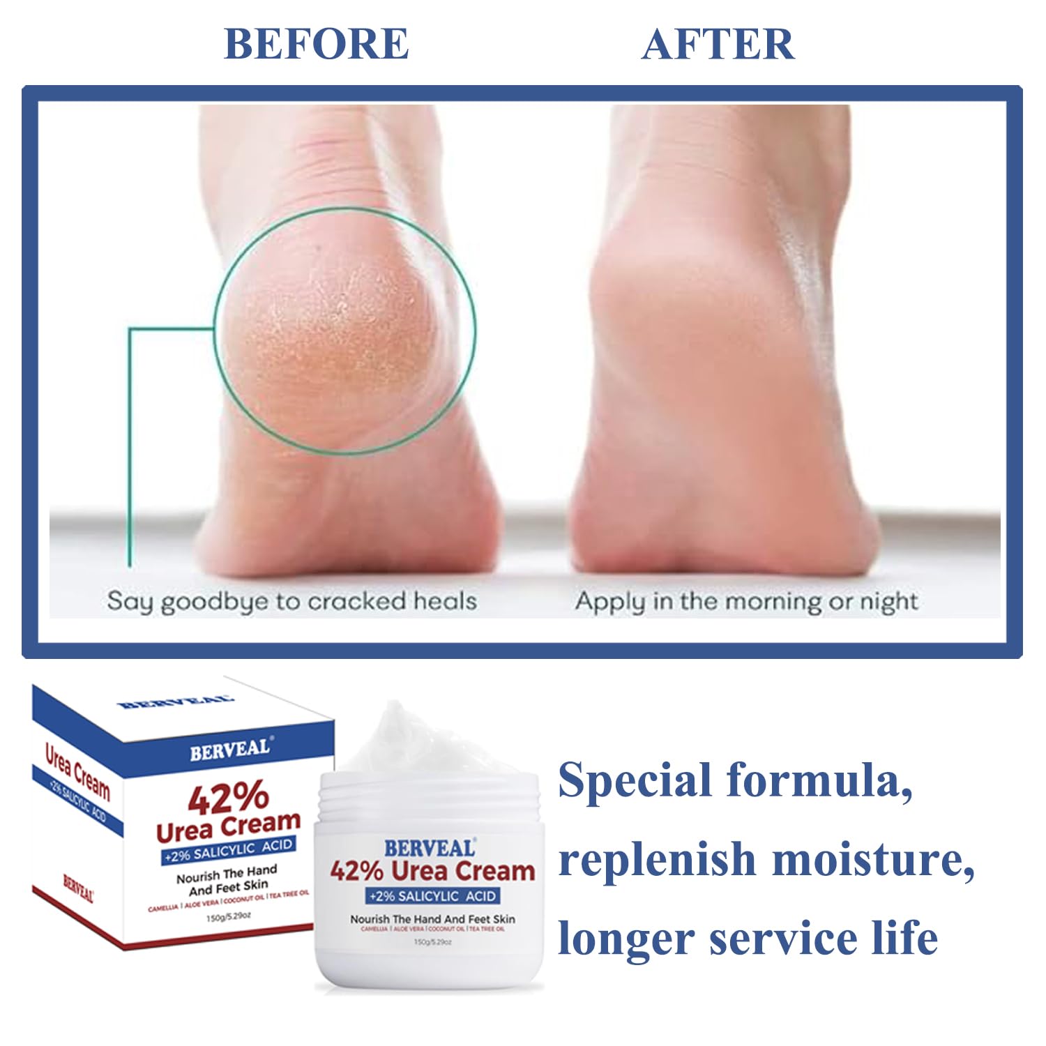 Urea Cream with 2% Salicylic Acid Foot Cream for Dry Cracked Heels, Heel Care Cream 5.29 Oz (Pack of 1)