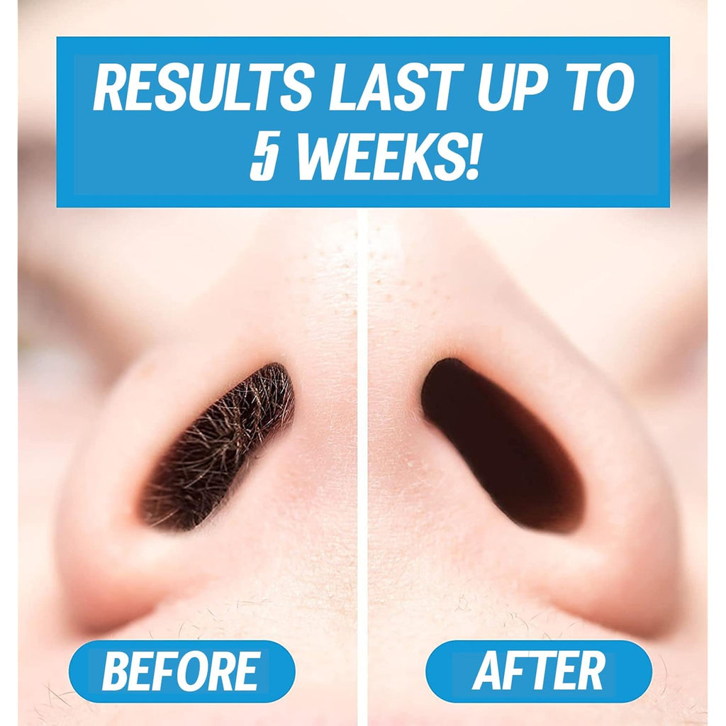 Nose Waxing Wax from Kenashii, 100g / 3.5 oz of Hypoallergenic Wax for Nasal Hair Removal, Specially Formulated to Never Get Brittle or Snap Off in Your Nose, Wipes and Applicators Sold Separately