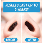 Nose Waxing Wax from Kenashii, 100g / 3.5 oz of Hypoallergenic Wax for Nasal Hair Removal, Specially Formulated to Never Get Brittle or Snap Off in Your Nose, Wipes and Applicators Sold Separately