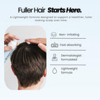 Vitafoam 5% Minoxidil Foam For Men & Women, Dht Blocking Minoxidil For Men Foam, Non-Greasy, Fast-Drying Formula For Hair Regrowth