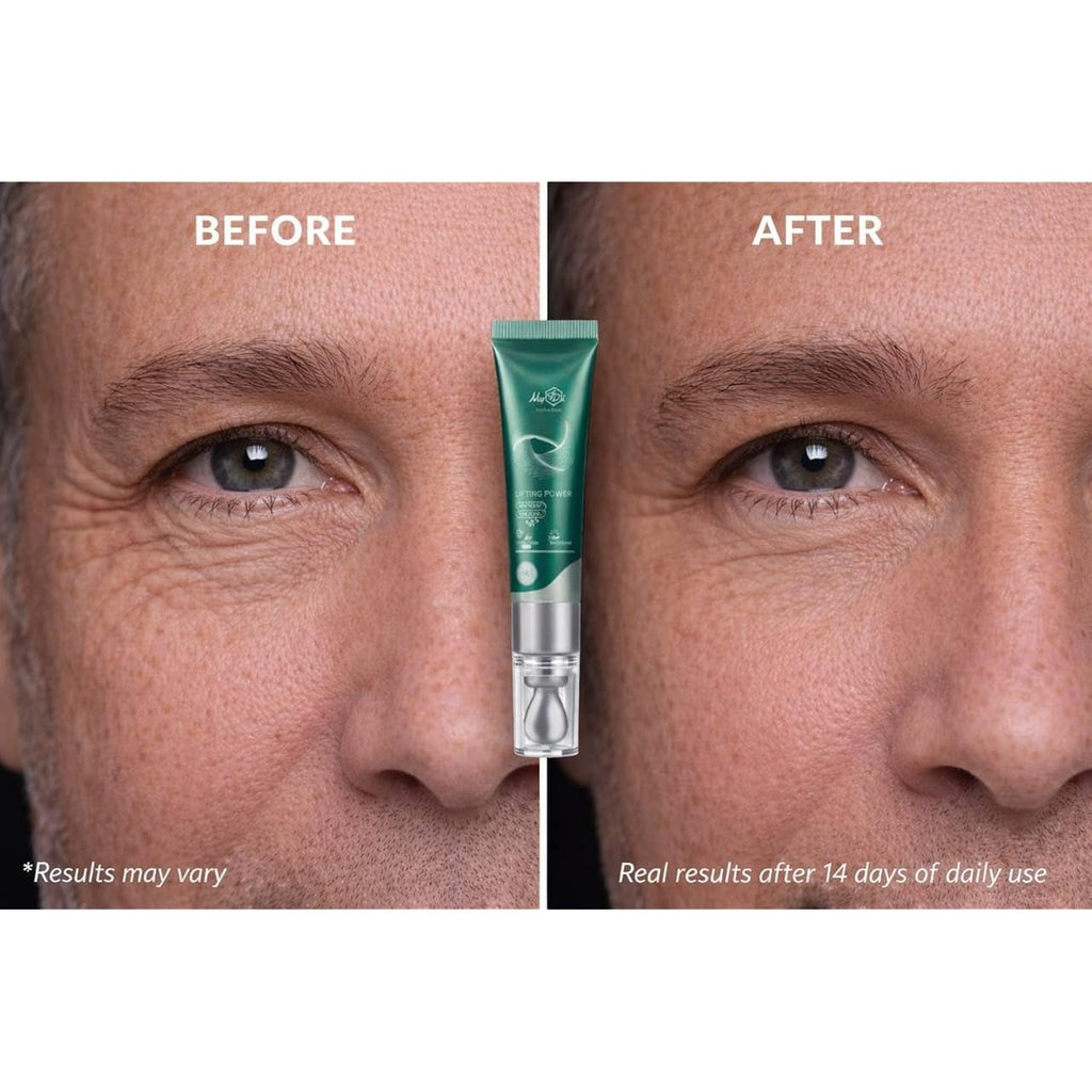 Lifting Power Eye Fluid – Eyelid Lifting Treatment For Hooded Eyes & Fine Lines – Multi-Peptide Eye Serum With Ceramide Ng, Hyaluronic Acid & Palmitoyl Tripeptide-1 – 0.5 Fl Oz / 15 Ml