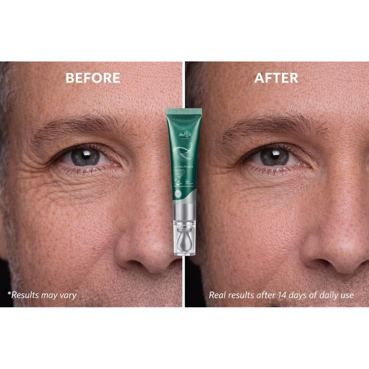Lifting Power Eye Fluid – Eyelid Lifting Treatment For Hooded Eyes & Fine Lines – Multi-Peptide Eye Serum With Ceramide Ng, Hyaluronic Acid & Palmitoyl Tripeptide-1 – 0.5 Fl Oz / 15 Ml