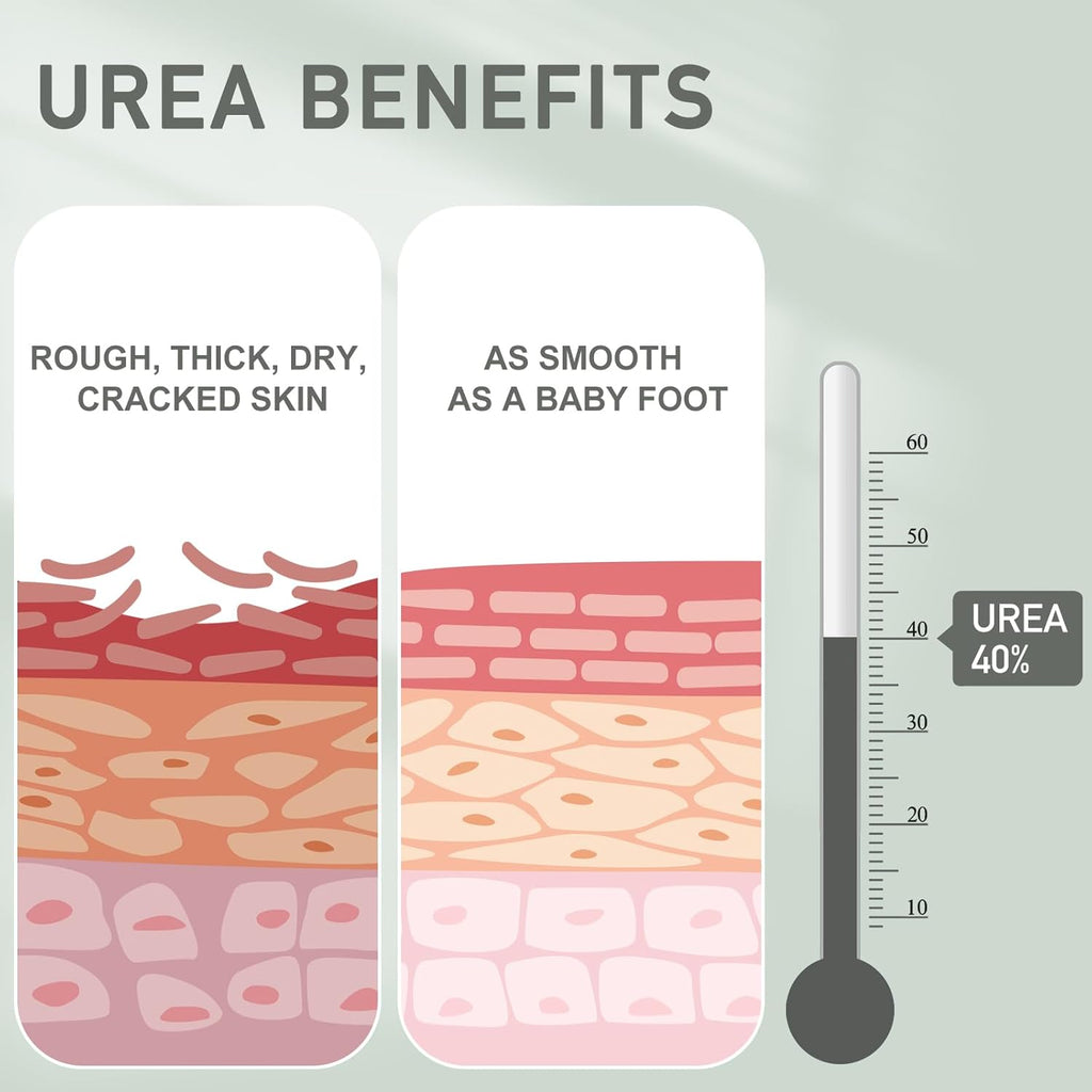 Urea Cream 40 Percent - Foot & Hand Cream for Dry, Cracked Heels, Feet, Knees, Elbows, and Hands - Maximum Strength Urea Lotion for Softening and Moisturizing