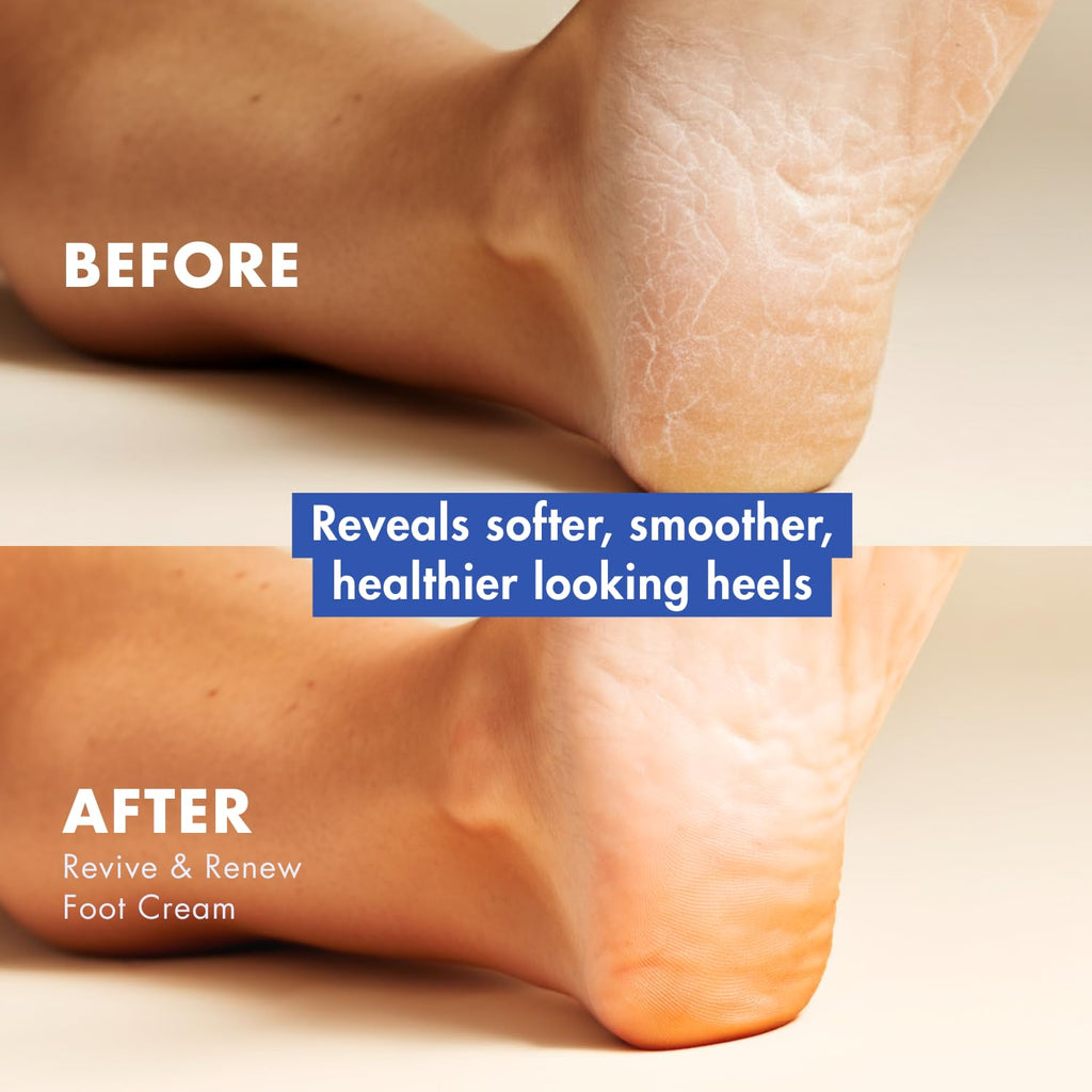 Handmade Heroes Revive & Renew Peppermint Foot Cream with Jojoba & Magnesium - Cooling Foot Relief for Tired, Dry Feet, Rough Heels & Calluses, 1.7 oz
