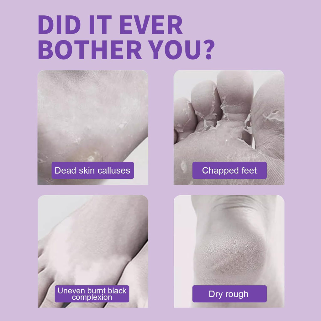 Foot Peeling Mask - 5 Pack Exfoliating Foot Peel Mask for Dry Cracked Feet - Baby Soft Foot Mask Socks for Removing Dead Skin, Cracked Heels, and Calluses - Lavender, Shea Butter, Aloe - Women and Men
