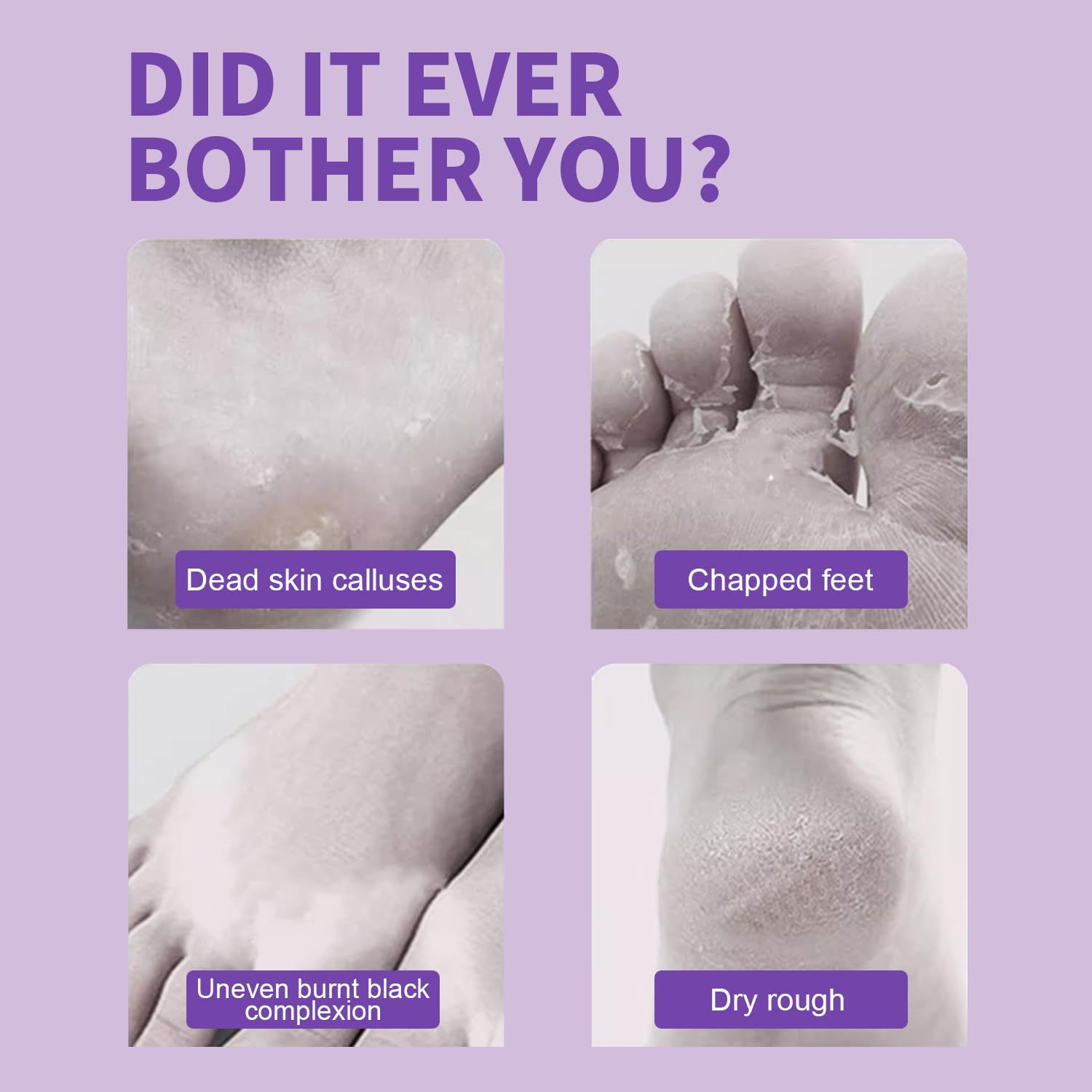 Foot Peeling Mask - 5 Pack Exfoliating Foot Peel Mask for Dry Cracked Feet - Baby Soft Foot Mask Socks for Removing Dead Skin, Cracked Heels, and Calluses - Lavender, Shea Butter, Aloe - Women and Men