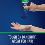 Selsun Blue Moisturizing Antidandruff Shampoo, Maximum Strength Scalp Treatment With Selenium Sulfide, 11 Fl. Oz.