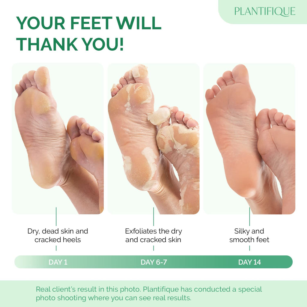 PLANTIFIQUE Foot Peeling Mask 2 Pack | Dermatologically Tested Repairs Heels & Removes Dry Dead Skin for Baby Soft Feet | Exfoliating Foot Peel Mask for Dry Cracked Feet | Peach