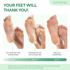 PLANTIFIQUE Foot Peeling Mask 2 Pack | Dermatologically Tested Repairs Heels & Removes Dry Dead Skin for Baby Soft Feet | Exfoliating Foot Peel Mask for Dry Cracked Feet | Peach