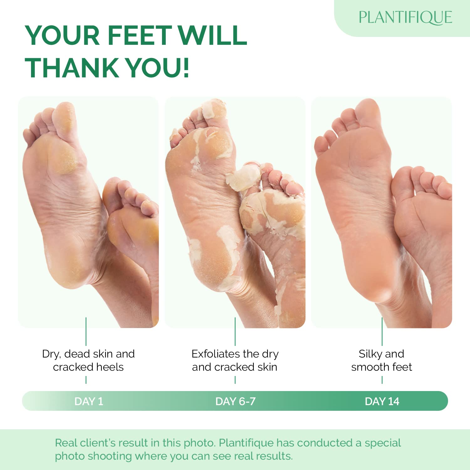 PLANTIFIQUE Foot Peeling Mask 2 Pack | Dermatologically Tested Repairs Heels & Removes Dry Dead Skin for Baby Soft Feet | Exfoliating Foot Peel Mask for Dry Cracked Feet | Peach