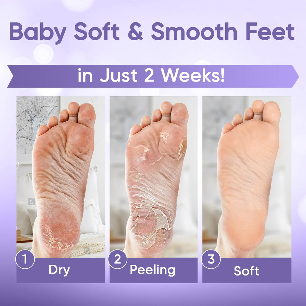 CÉLOR Foot Peeling Mask for Dry Cracked Feet | Foot Mask to Exfoliate Rough, Cracked, Dry Feet, Calluses for Soft Baby Feet Results | Made with Aloe Vera Extract for Women & Men (2 Pairs) | Lavender