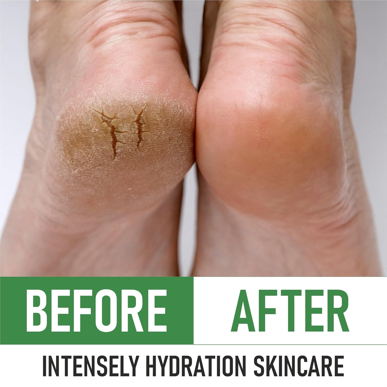 PurOrganica Urea 40% Foot Cream – Made in USA, Dermatologist Tested, Intensive Repair for Dry, Cracked Heels, Corns, Calluses & Rough Feet, Professional Strength Exfoliating & Moisturizing Cream