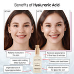 Grace & Stella Award Winning Hyaluronic Acid Serum (50Ml/1.7 Fl Oz) Hydrating Hyaluronic Acid Serum For Face - Acido Hialuronico For Women - Remove Fine Lines, Wrinkles, Anti Aging - Vegan Skincare