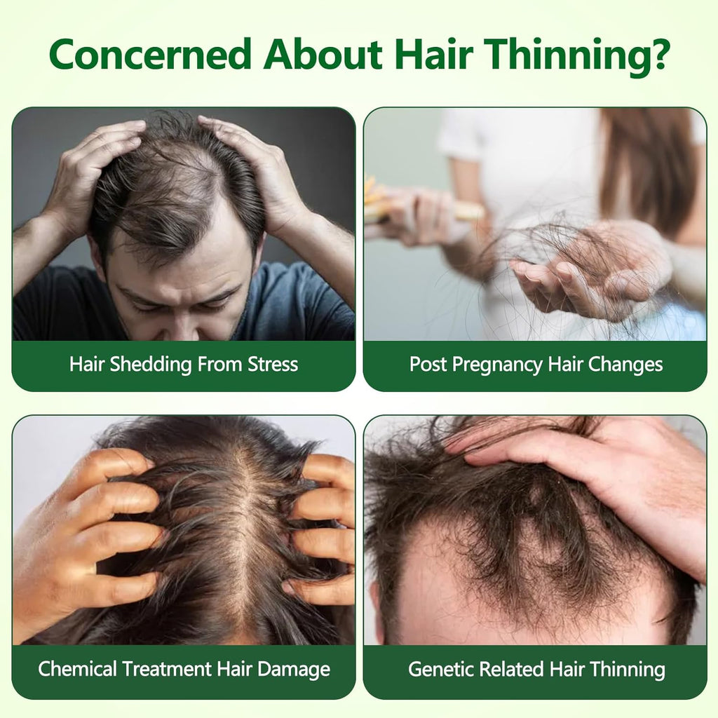 Hair Growth Serum Roll-On, Reduces Hair Shedding & Strengthens Roots, Helps Support Thicker, Fuller Hair, 3% Rosemary, 2% Ginger, 1.5% Pea Extract, 0.85 Fl Oz (Pack of 2)