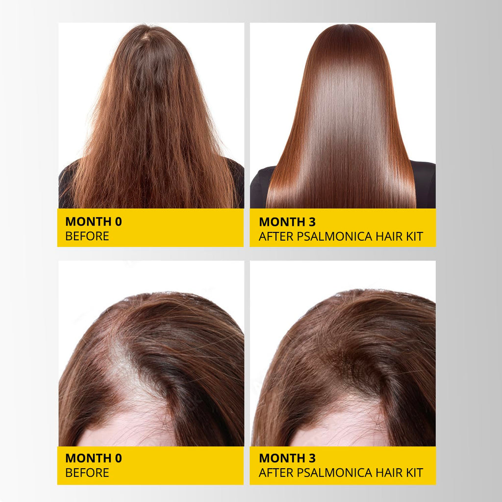 Hair Growth Shampoo And Conditioner Set: Sulfate Free Hair Growth Root Activator Thickening Shampoo For Hair Loss And Thinning Hair - Hair Loss Regrowthtreatments For Women Men