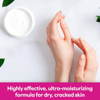 Udderly Smooth Extra Care Hand, Body & Foot Cream With 20% Urea, Daily Moisturizer To Restore Dry Or Irritated Skin, Dermatologist Tested, 8 Oz