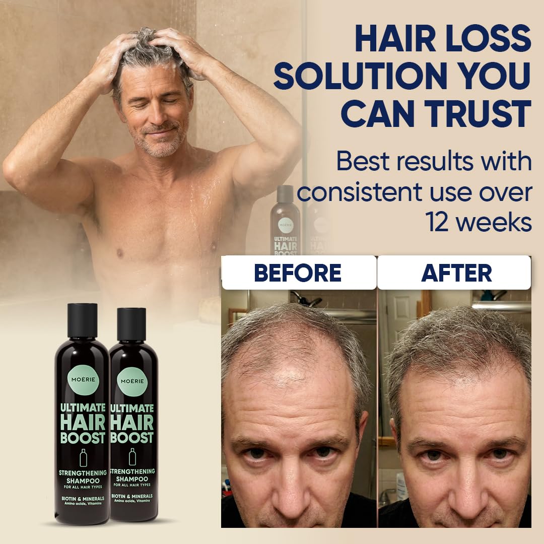 Moerie Hair Growth Shampoo For Men And Women, Hair Loss Solution With Biotin And Rosemary, Thickening Shampoo For Thinning Hair – Ultimate Boost For All Hair Types