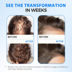 Hair Growth Spray for Thicker Longer Hair -Batana Oil & Thuja Extract Scalp Serum for Thinning &Loss Support - Volumizing Treatment for women & Men,Non-Greasy, 2 fl oz
