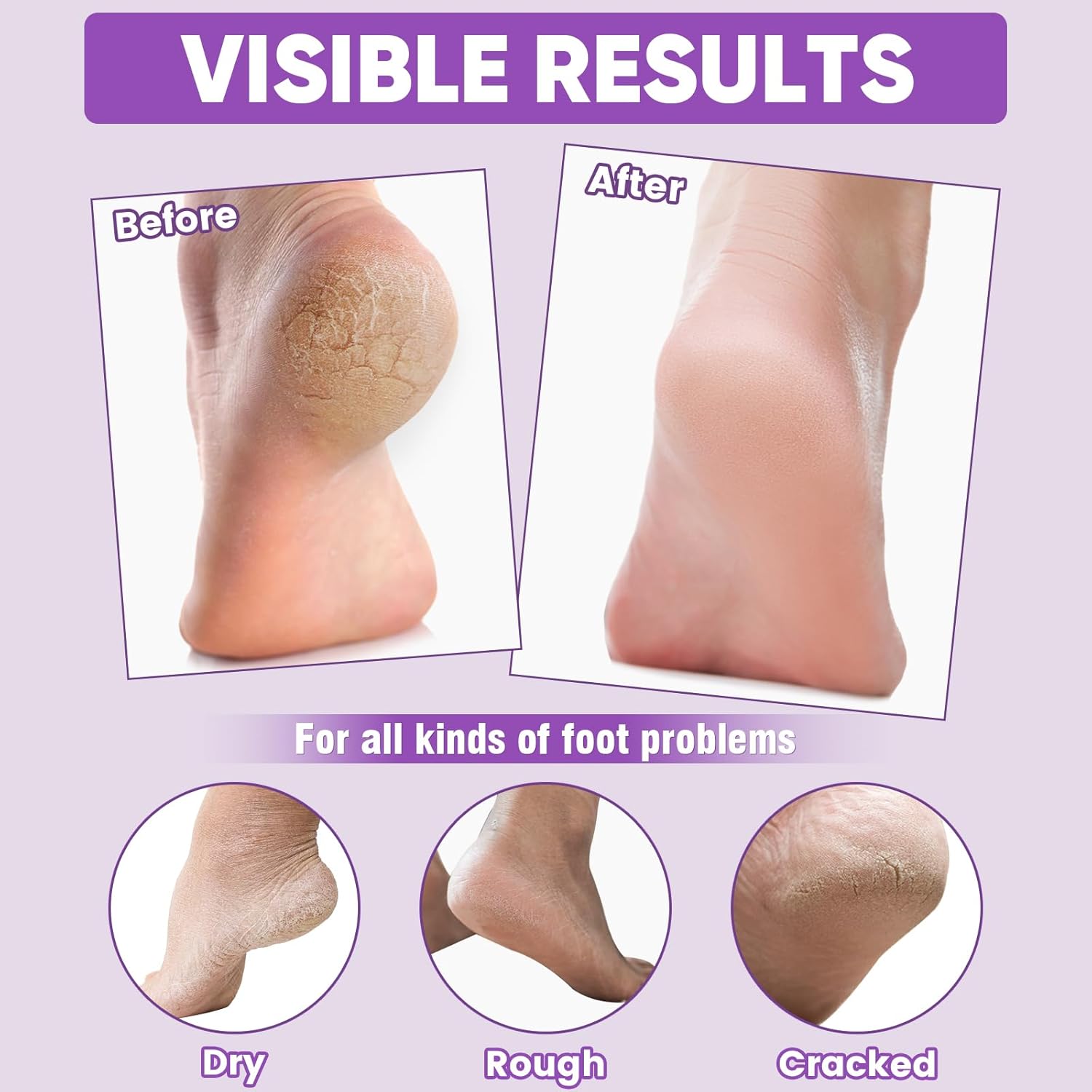 TEAWOO 8 Pairs Moisturizing Foot Masks with Lavender Oil & Jojoba Oil, Intensely Hydrating Foot Mask for Dry Cracked Feet, Moisturizing Socks for Cracked Heel Treatment