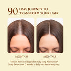 Hair Growth Serum: Rosemary Batana Castor Oil Rice Water Biotin Hair Oils For Hair Growth - Hair Growth Thickening Product - Hair Loss Treatments For Women Men(50 Ml)