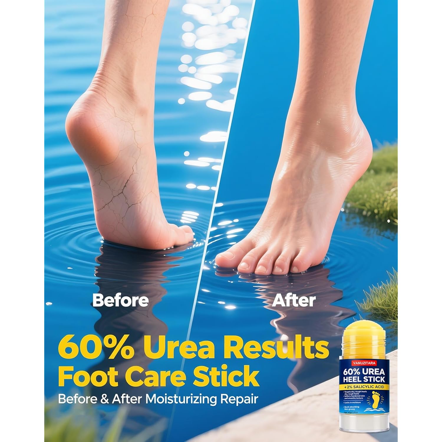 Urea Cream 60% with 2% Salicylic Acid, Foot Cream 60 Percent for Feet & Hands, Maximum Strength Urea Stick for Rough, Dry Cracked Feet Hands Elbows, Callus Remover, Skin Softener Balm 1.41oz