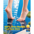 Urea Cream 60% with 2% Salicylic Acid, Foot Cream 60 Percent for Feet & Hands, Maximum Strength Urea Stick for Rough, Dry Cracked Feet Hands Elbows, Callus Remover, Skin Softener Balm 1.41oz