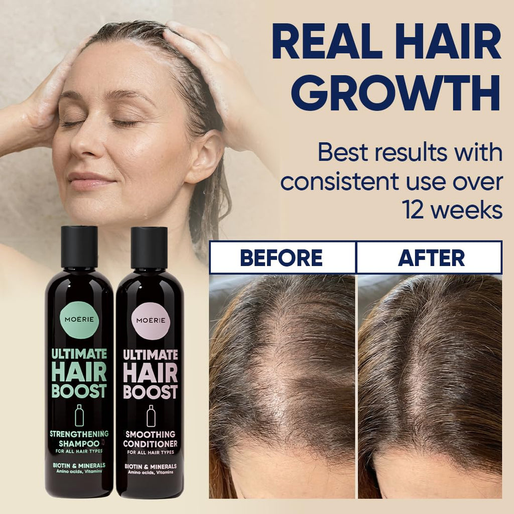 Moerie Hair Growth Shampoo And Conditioner For Women And Men, Hair Loss Solution With Biotin And Rosemary, Thickening Shampoo And Conditioner For Thinning Hair – Promotes Regrowth