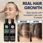 Moerie Hair Growth Shampoo And Conditioner For Women And Men, Hair Loss Solution With Biotin And Rosemary, Thickening Shampoo And Conditioner For Thinning Hair – Promotes Regrowth