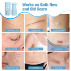 Silicone Scar Stick, 80% Silicone Stick For Face And Body. Silicone Stick For Removal Of Surgical,Old And Recent Scars And Stretch Marks - 7G