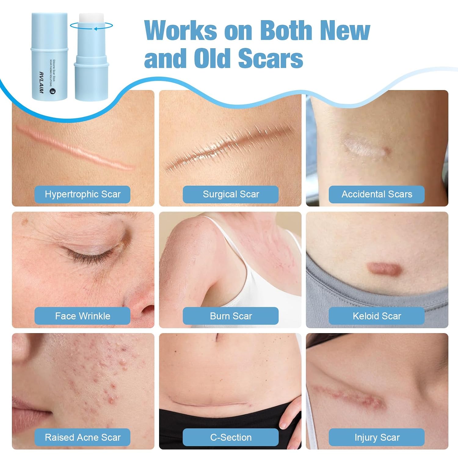 Silicone Scar Stick, 80% Silicone Stick For Face And Body. Silicone Stick For Removal Of Surgical,Old And Recent Scars And Stretch Marks - 7G