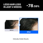 Refilled Cadpr Booster Plus Balancing Hair Growth Serum For Sensitive Scalp | Hair Density & Lightweight Moisture Scalp Care, Thin & Weak Hair, Non-Greasy With Built-In Scalp Massager
