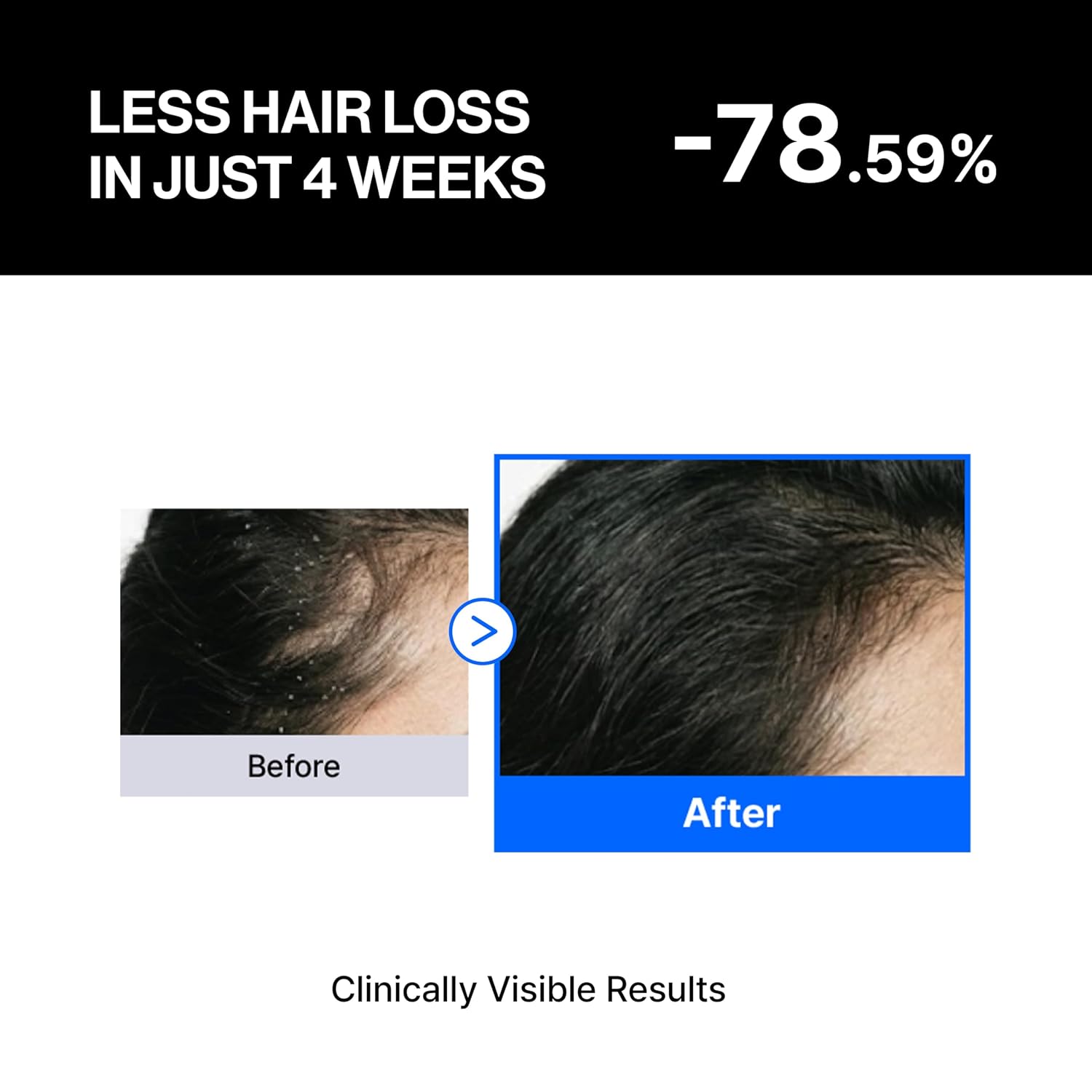 Refilled Cadpr Booster Plus Balancing Hair Growth Serum For Sensitive Scalp | Hair Density & Lightweight Moisture Scalp Care, Thin & Weak Hair, Non-Greasy With Built-In Scalp Massager