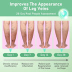 Healrize VeinTarget Microdarts Patch, Vein Target Microdarts Patch, Relieves Leg Discomfort, Moisturizes and Smooths Skin(3 Boxes)
