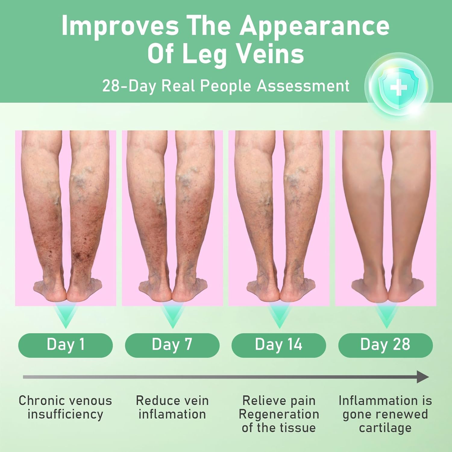Healrize VeinTarget Microdarts Patch, Vein Target Microdarts Patch, Relieves Leg Discomfort, Moisturizes and Smooths Skin(3 Boxes)