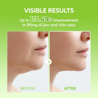 Dr.Melaxin Cactox V-Lifting Mewing Band – Cactox + Caffeine + Collagen Double Chin Lifting Band For Sagging Jawline & Facial Puffiness | 115.49% Jaw & Chin Lifting Improvement | Korean V-Line Lifting