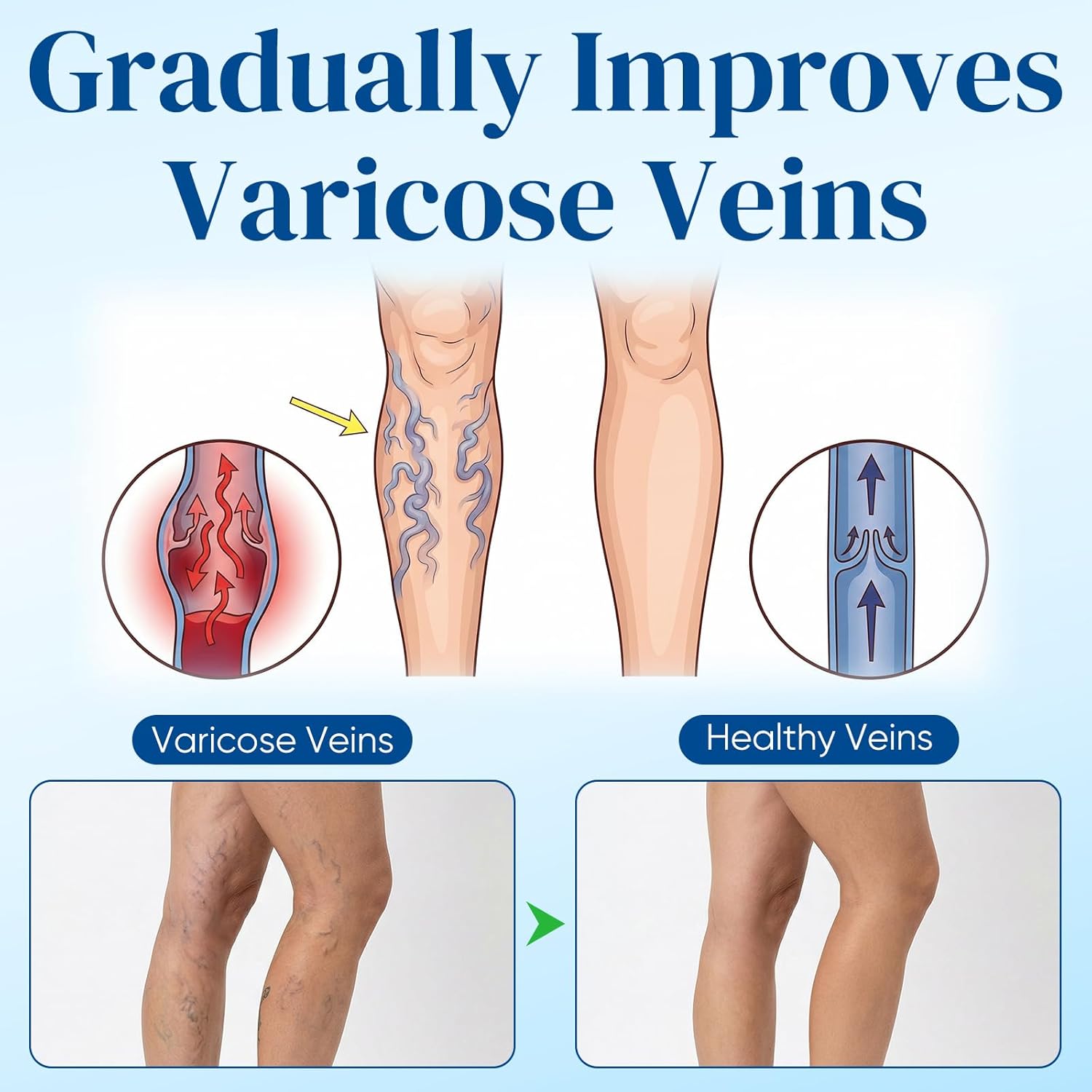 Vein Target Microdarts Patch, Professional Varicose Veins for Legs Patch, Natural Ingredients Leg Treatment for All Skin Types (2 Pack)
