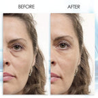 Puffy Eye Gel Instant Results – Naturally Rapid Reduction Eye Gel, Eliminate Wrinkles, Puffiness And Bags – Hydrating Eye Gel W/Green Tea Extract By Aqua Mineral – 1 Oz