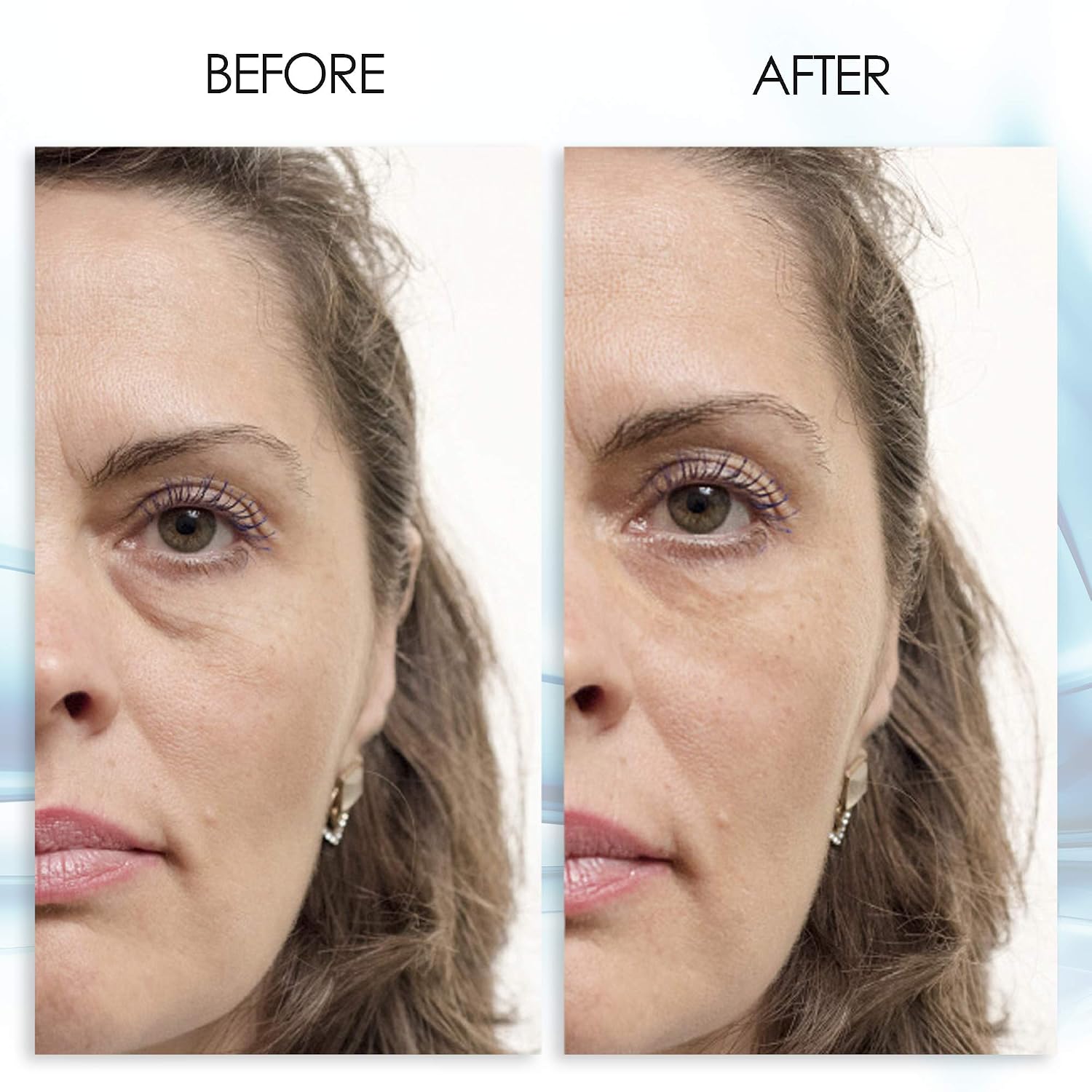 Puffy Eye Gel Instant Results – Naturally Rapid Reduction Eye Gel, Eliminate Wrinkles, Puffiness And Bags – Hydrating Eye Gel W/Green Tea Extract By Aqua Mineral – 1 Oz