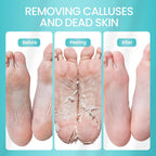 SUNATORIA Foot Peeling Mask (2 Pack) – Exfoliating Foot Mask for Dry Cracked Feet & Calluses – Baby Soft Touch Foot Peel Mask with Aloe Vera – Peeling Socks for Men & Women