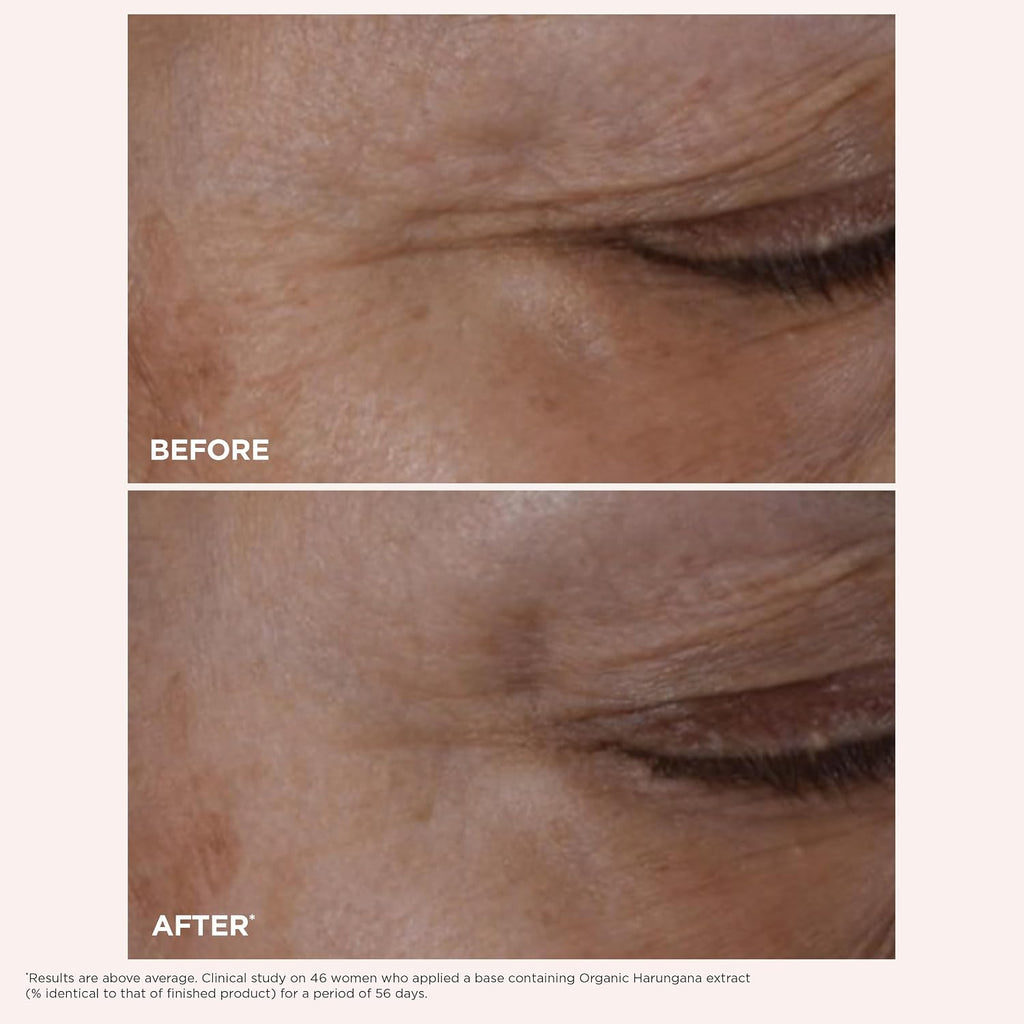 Clarins Total Eye Lift | Anti Aging Eye Cream | Targets Wrinkles, Crow'S Feet, Dark Circles And Puffiness For A Visible Eye Lift In 30 Seconds | Refillable