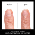 butter LONDON Cuticle Remover Liquid, Melt Away - Cuticle Softener Oil Exfoliator Gently Removes Dry & Overgrown Skin - Nail Care for Clean & Healthy-Looking Nails, Home Manicure & Pedicure, 6ml