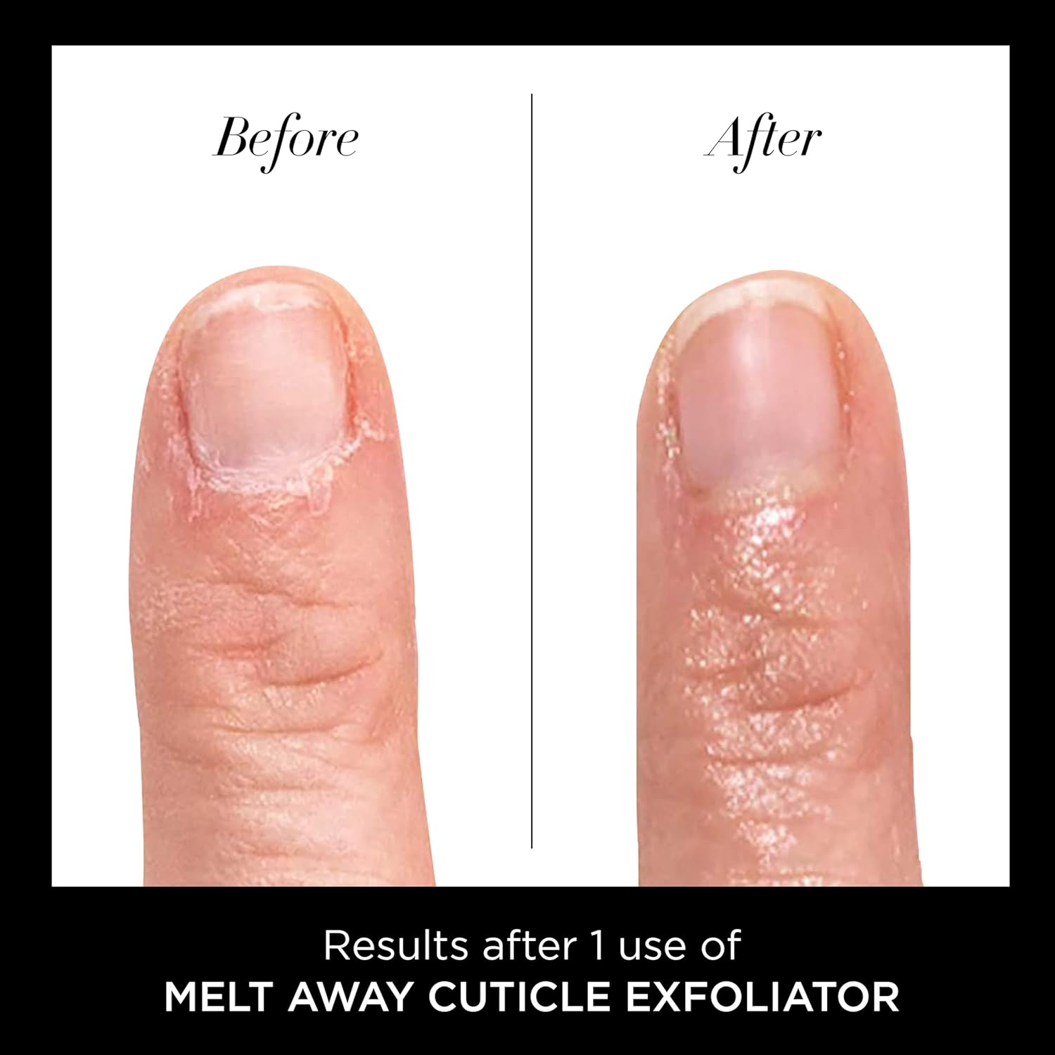 butter LONDON Cuticle Remover Liquid, Melt Away - Cuticle Softener Oil Exfoliator Gently Removes Dry & Overgrown Skin - Nail Care for Clean & Healthy-Looking Nails, Home Manicure & Pedicure, 6ml