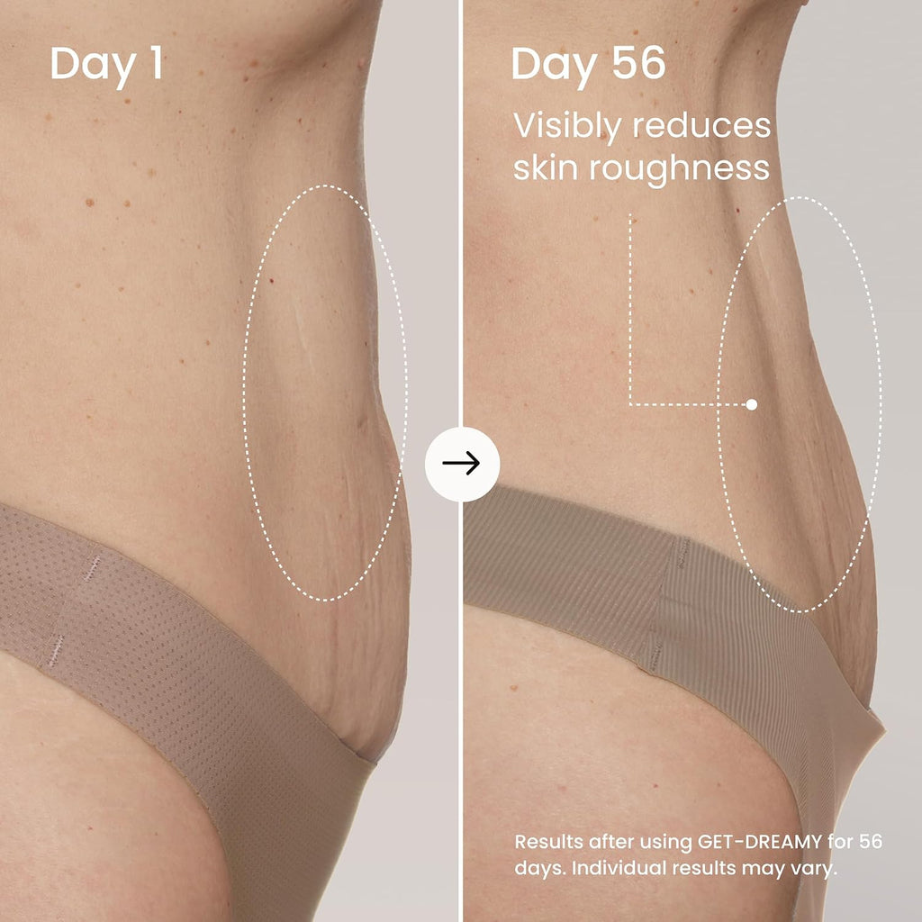 Maëlys Get-Dreamy Overnight Toning Whip - Cellulite Cream & Skin Tightening Support With Milk Thistle + Uva-Ursi - Moisturizing Body Cream In A Whipped Texture (6.8 Fl Oz)