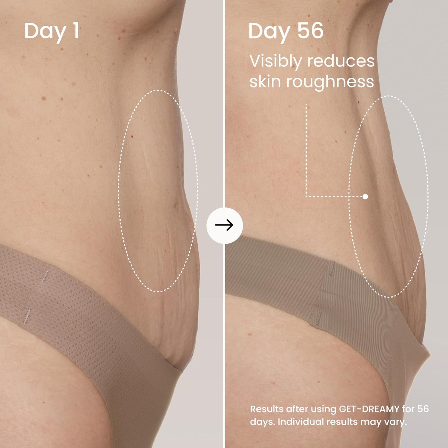 MAËLYS GET-DREAMY Overnight Toning Whip - Cellulite Cream & Skin Tightening Support with Milk Thistle + Uva-Ursi - Moisturizing Body Cream in a Whipped Texture (6.8 Fl Oz)