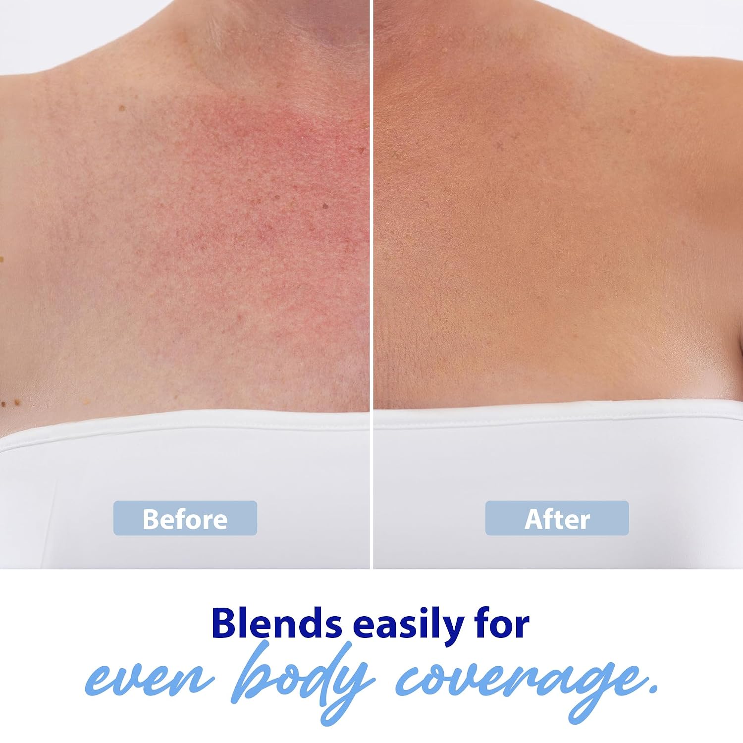 Dr. Denese Glow Younger Body Concealer 3.4 Oz – Leg & Body Makeup For Veins, Bruises, Scars, Discoloration, Age And Sun Spots – Full Coverage Concealer & Hydrating Transfer-Resistant Cream – Natural